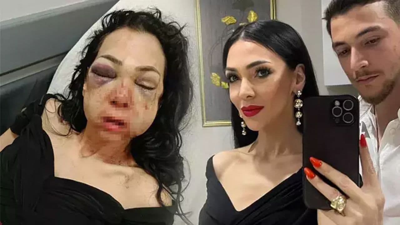 İzmit'te Bayram Günü Saldırısı: Anne ve Oğul Darp Edildi, Kadın Konuştu