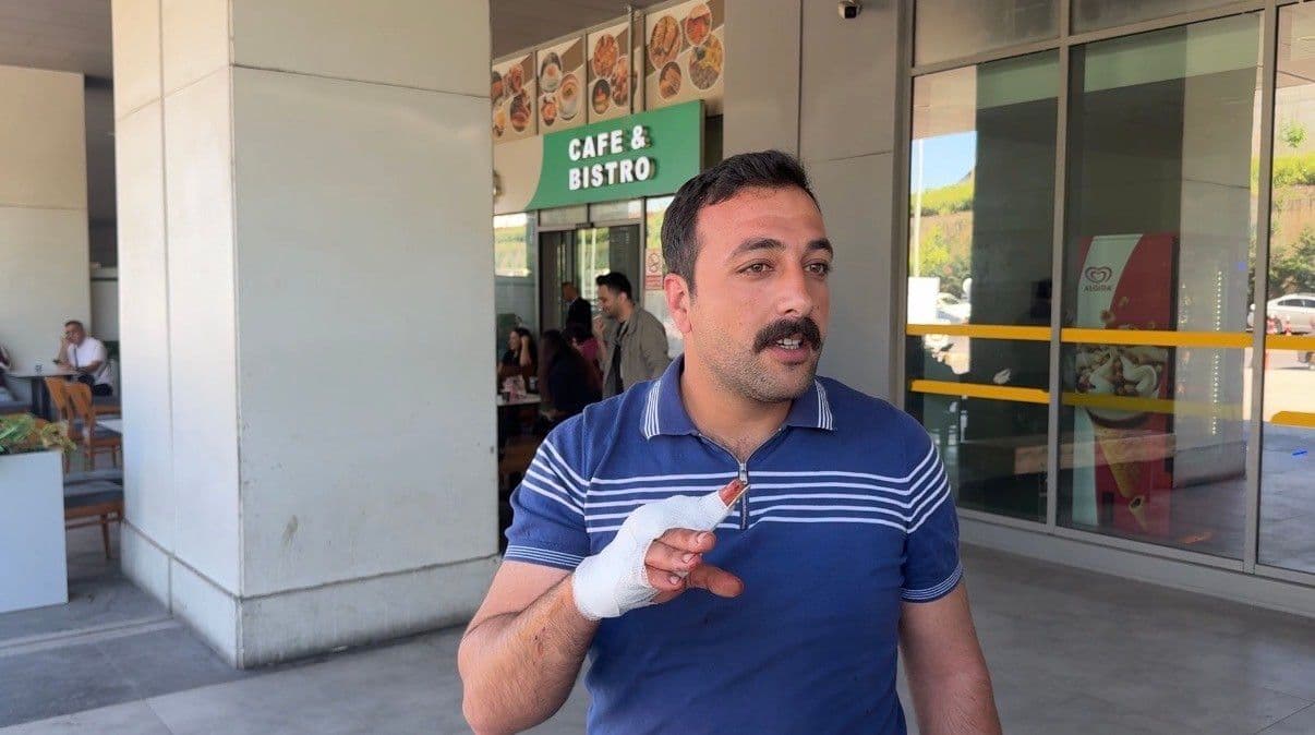 Kocaeli'de Kurban Bayramı'nda kurban keserken yaralanan Rıdvan Karakaya'nın hastane önünde sargılı eliyle çekilmiş fotoğrafı.