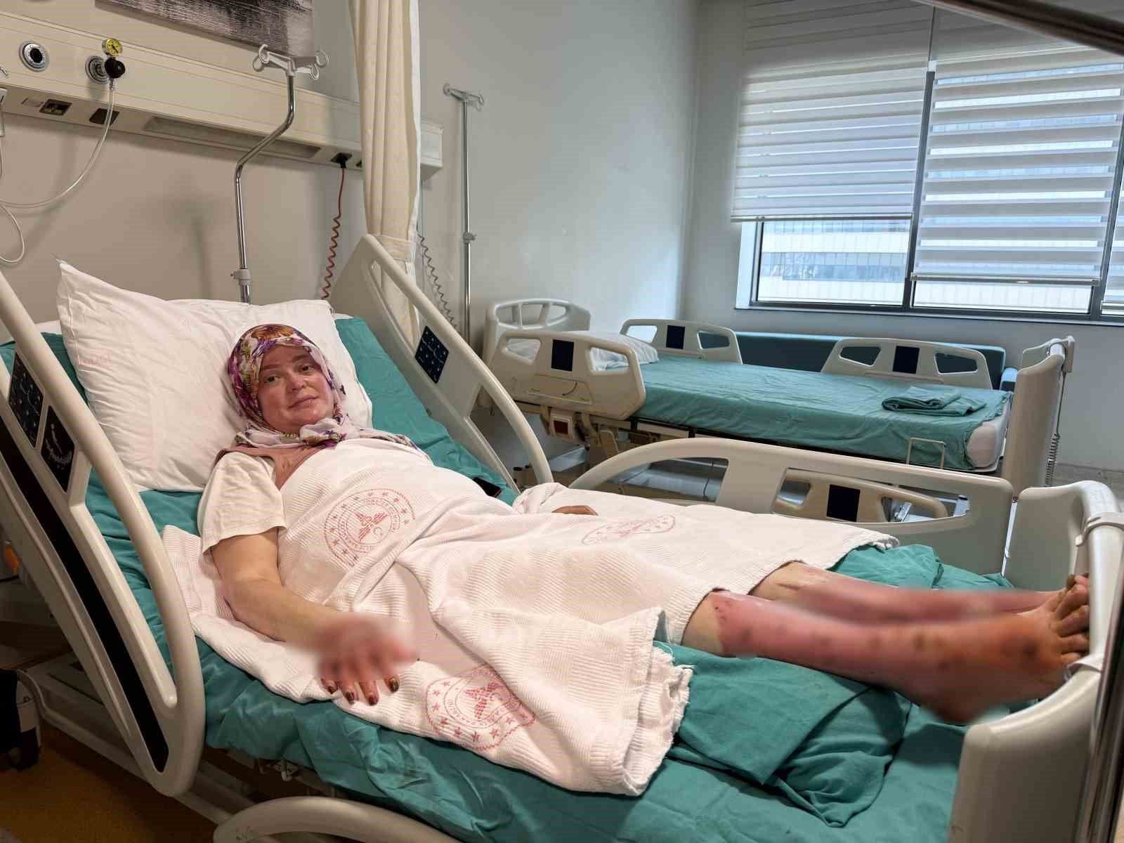 Karavan patlamasında yaralanan Şehri Kocaman hastane yatağında tedavi görüyor.