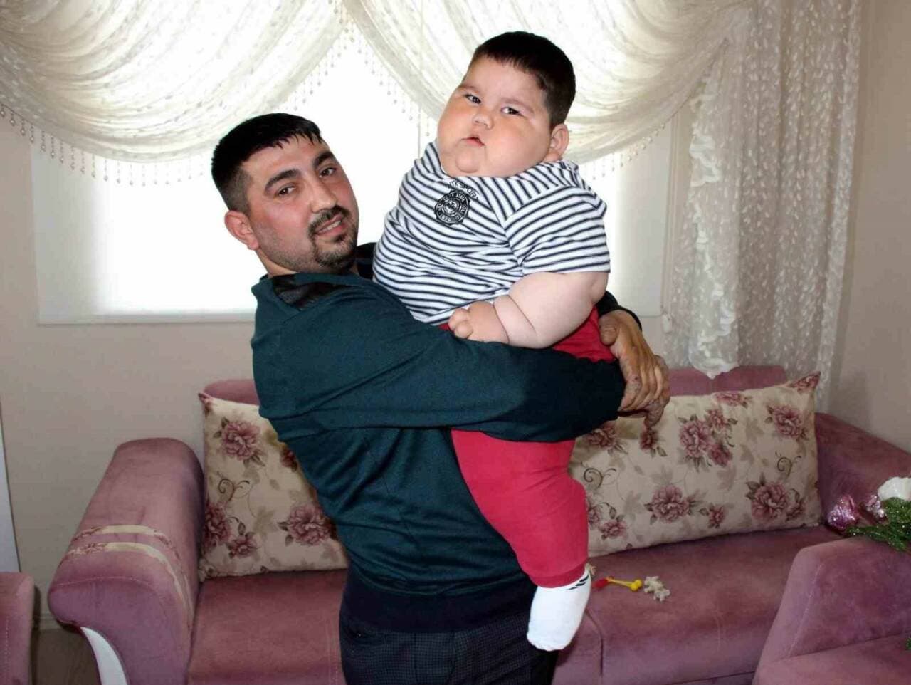 Leptin Eksikliğiyle Mücadele Eden Yağız, Tedaviyle Sağlığına Kavuştu