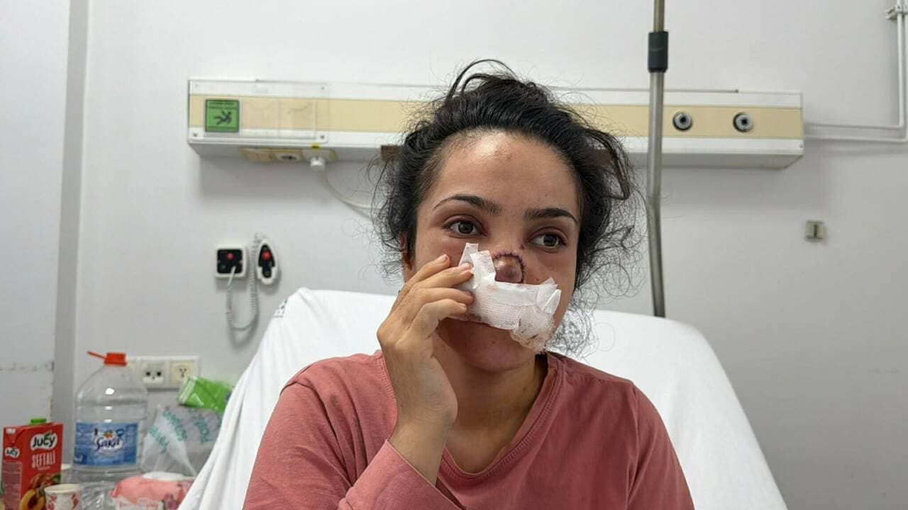 Bursa Yıldırım'da Eşinin Burnunu Kopardığı İddia Edilen Şahıs Tutuklandı